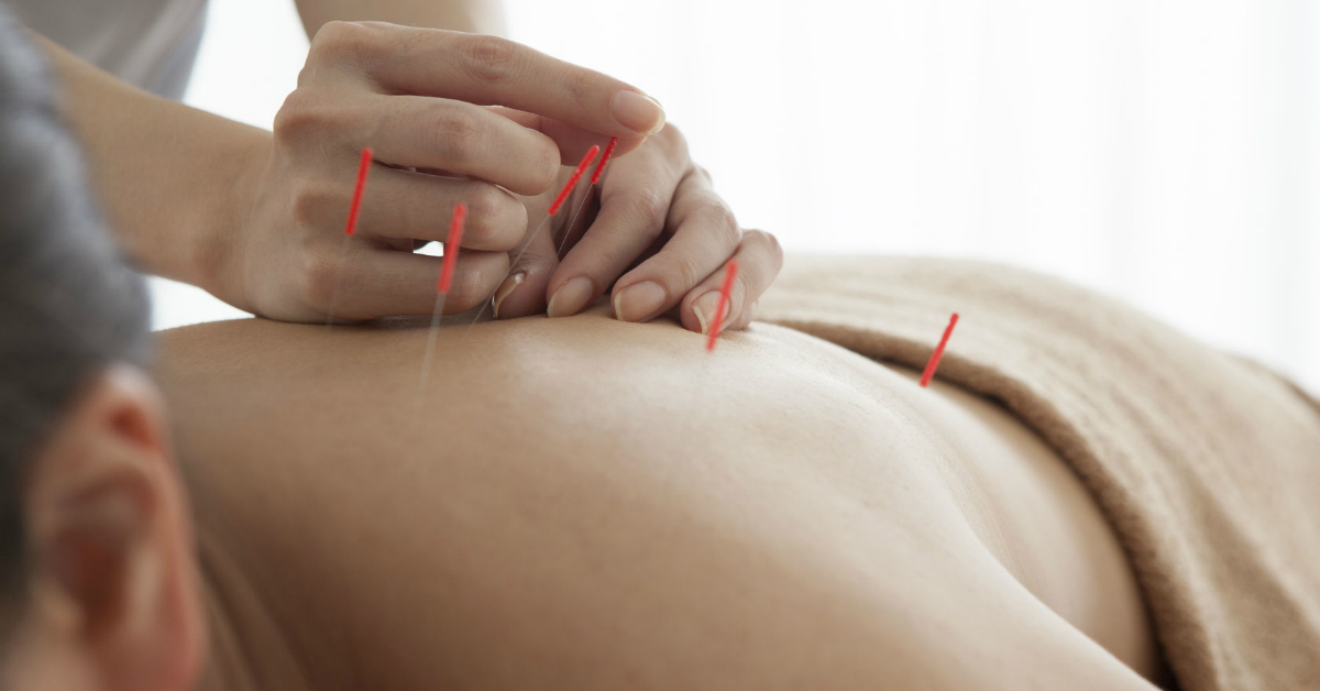 Benefits of Maui Acupuncture & Herbal Medicine
